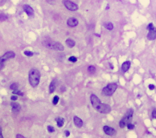 Epitheloidzellen